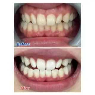 MBEAUTYSALON 千葉店・京成大久保所属・Melty 輝のその他イメージ