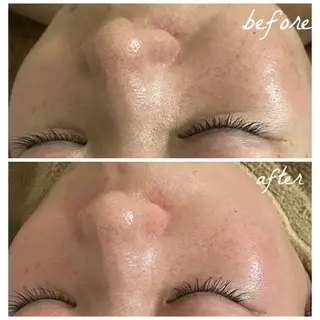 メンズ メナード岐阜茜部 杉浦のエステ・リラクイメージ