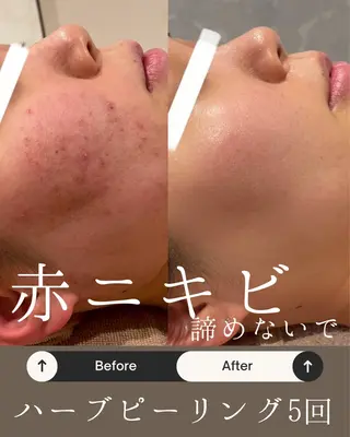 Anpawman所属・Anpawman アンパウマンのエステ・リラクイメージ