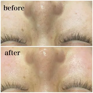 ハーブピーリング専門店 Ribboｰn所属・川田 弥生のエステ・リラクイメージ