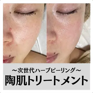 渡邊 千夏のエステ・リラクイメージ