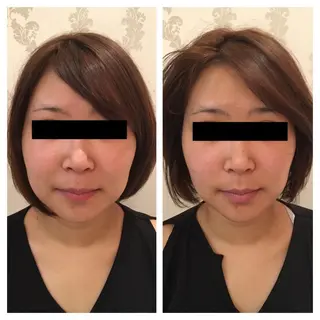 美容鍼サロン    Fleurir所属・伊藤 かなえのエステ・リラクイメージ