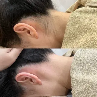 スターラッシュ薬院本店所属・スターラッシュ staffのエステ・リラクイメージ