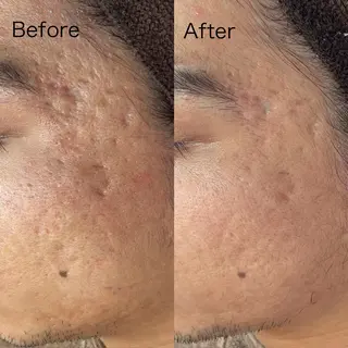 BELLIS HUIT所属・ハーブピーリング那覇 BELLISHUITのエステ・リラクイメージ