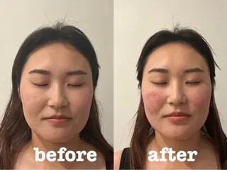 美容鍼灸Solana所属・肌質改善×美容鍼 ゆいのエステ・リラクイメージ