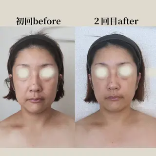 小顔コルギ&肌質改善 の専門店LIBREのエステ・リラクイメージ