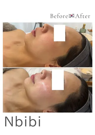 韓国🇰🇷価格 サロン_Nbibiのエステ・リラクイメージ