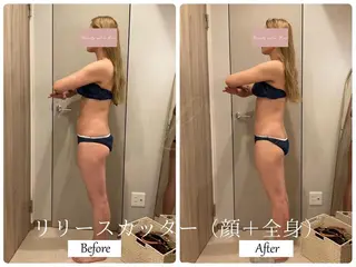 ブライダルサロン ｜Lino【堀江】のエステ・リラクイメージ