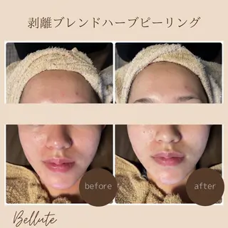 ピーリング専門店 Belluteのエステ・リラクイメージ
