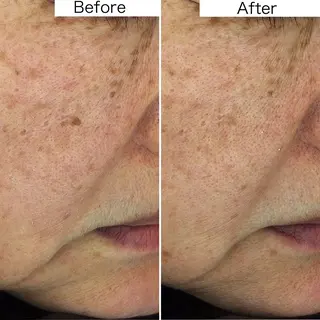 医師推奨サロン ディーキャットリーのエステ・リラクイメージ