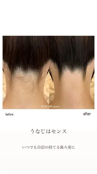 ワックス脱毛🌈 ESPOIRnocoのエステ・リラクイメージ