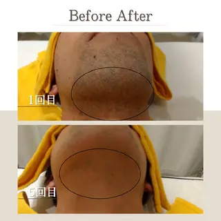 メンズ EDEL エーデルのエステ・リラクイメージ