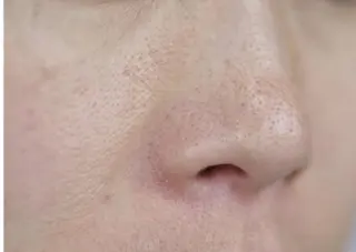 内山 なみのエステ・リラクイメージ