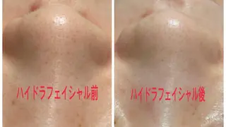 首・肩こり専門リンパ ケアサロンSENKAのエステ・リラクイメージ