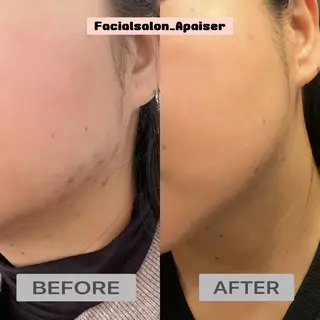 エイジングケアサロン Apaiserのエステ・リラクイメージ