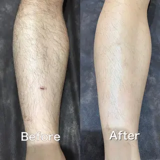 ロング カラー パーマ ヘアアレンジ メンズ キッズ ネイル マツエク・マツパ Chloe-クロエ- 脱毛/フェイシャルのエステ・リラクイメージ