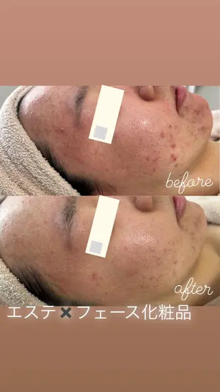 都度払い肌改善専門店 店長二上文香のエステ・リラクイメージ