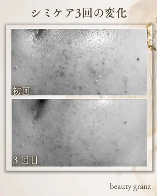 毛穴ニキビ専門 ビューティーグランツのエステ・リラクイメージ