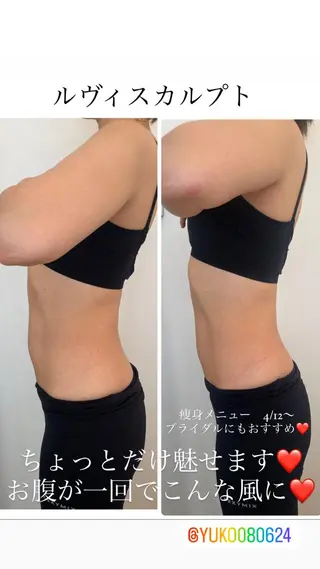 ニキビ・毛穴改善 🌿ハーブピーリングのエステ・リラクイメージ