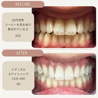 Whitening Carat 恵比寿店所属・ホワイトニング カラット 恵比寿店のエステ・リラクイメージ