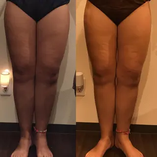 毒素出し専門サロンSylph(なかがわ整骨院併設サロン)所属・Mami Hataのエステ・リラクイメージ