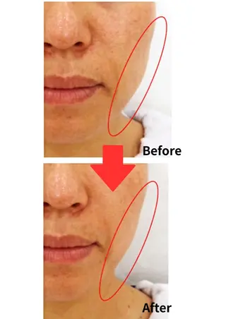 Belle White所属・本格痩身＊透明美肌 BelleWhiteのエステ・リラクイメージ