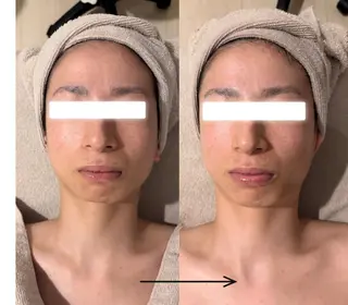 POLA THE BEAUTY 天王寺店所属・UEDA | POLA 天王寺のエステ・リラクイメージ