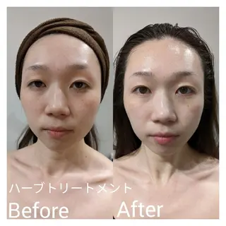 ﾌｪｲｼｬﾙｴｽﾃ ﾗﾄｩｰﾙ伊深のエステ・リラクイメージ