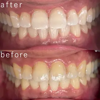 サクッとホワイト都立大学店所属・セルフホワイトニング 都立大学🦷✴︎のその他イメージ