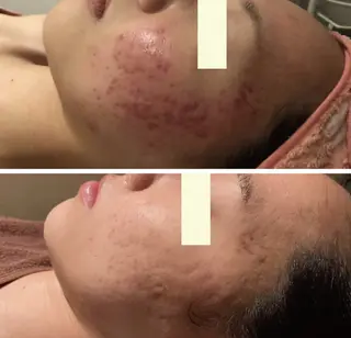 💐美肌/小顔づくり 🫧看護師🫧ASAのエステ・リラクイメージ