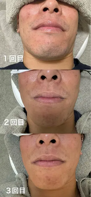 メンズ Akala miのエステ・リラクイメージ