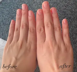 韓国/ピーリング 毛穴洗浄/POLAのエステ・リラクイメージ