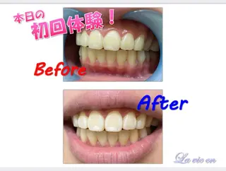 セルフホワイトニングサロン　ラヴィアン所属・ホワイトニングサロン La vie enのその他イメージ