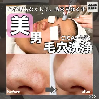 メンズ NONOKEKE ノノケケのエステ・リラクイメージ