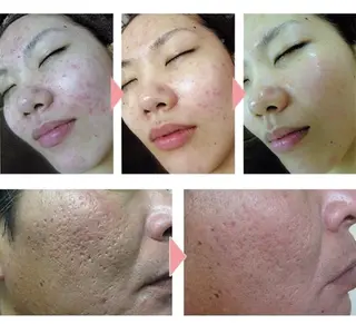 mindplus(マインドプラス)所属・mind plus 【小顔　痩身　脱毛】のエステ・リラクイメージ