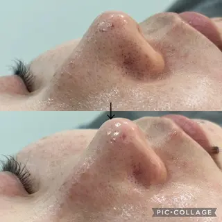 カンナムビューティー 新宿🦋碧.aoiのエステ・リラクイメージ