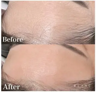 Eyelash Salon Blanc 大津膳所店所属・Blanc サカモトのエステ・リラクイメージ