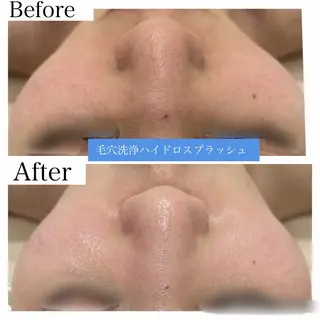 ブライダル痩身×脱毛 尼崎駅前サロンのエステ・リラクイメージ