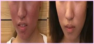 HARIS(ハリス) 院長Shimのエステ・リラクイメージ