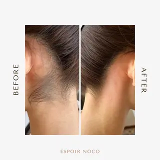 ワックス脱毛🌈 ESPOIRnocoのエステ・リラクイメージ