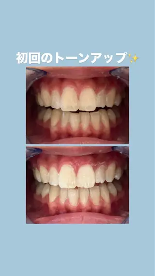 セルフホワイトニングサロンエクシアホワイト倉敷店所属・ecxiawhite 倉敷店のエステ・リラクイメージ