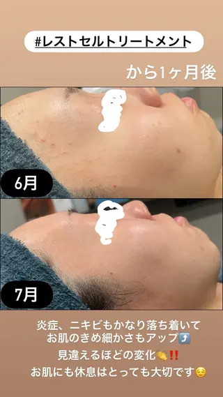 LiZA エステティックサロンのエステ・リラクイメージ