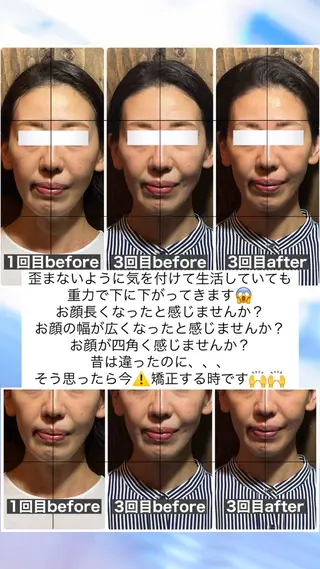 💎後悔させない小顔 矯正💎イトヤマ🌱のエステ・リラクイメージ