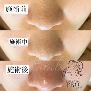 毛穴専門サロン　フルール所属・フルールFululu 自由が丘のエステ・リラクイメージ