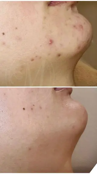 salon de beauté More所属・More 大阪福島区 毛穴・肌質改善のエステ・リラクイメージ