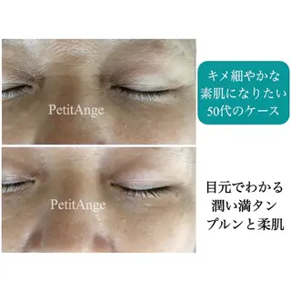 プチアンジェ所属・艶肌&小顔リフト❤︎ プチアンジェ茅ヶ崎のエステ・リラクイメージ