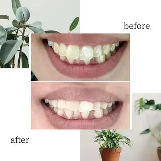 脱毛専門サロンELIXIR（ｴﾘｸｻｰ）所属・脱毛&ホワイトニング ELIXIR×ULTのエステ・リラクイメージ