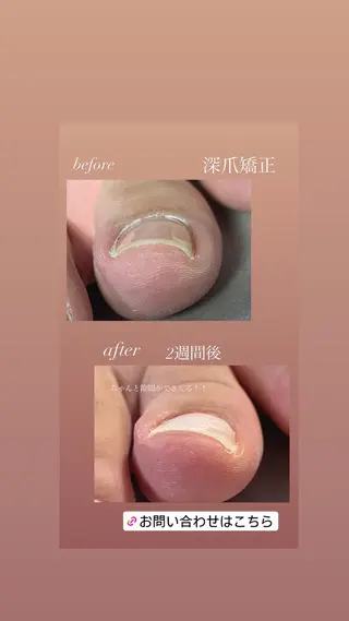 ネイル mima nailのネイルデザイン