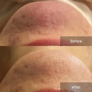 Mandarin Orange所属・毛穴から始める肌メン テマンダリンオレンジのエステ・リラクイメージ