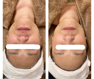 肌悩み改善 〜エステサロン〜のエステ・リラクイメージ